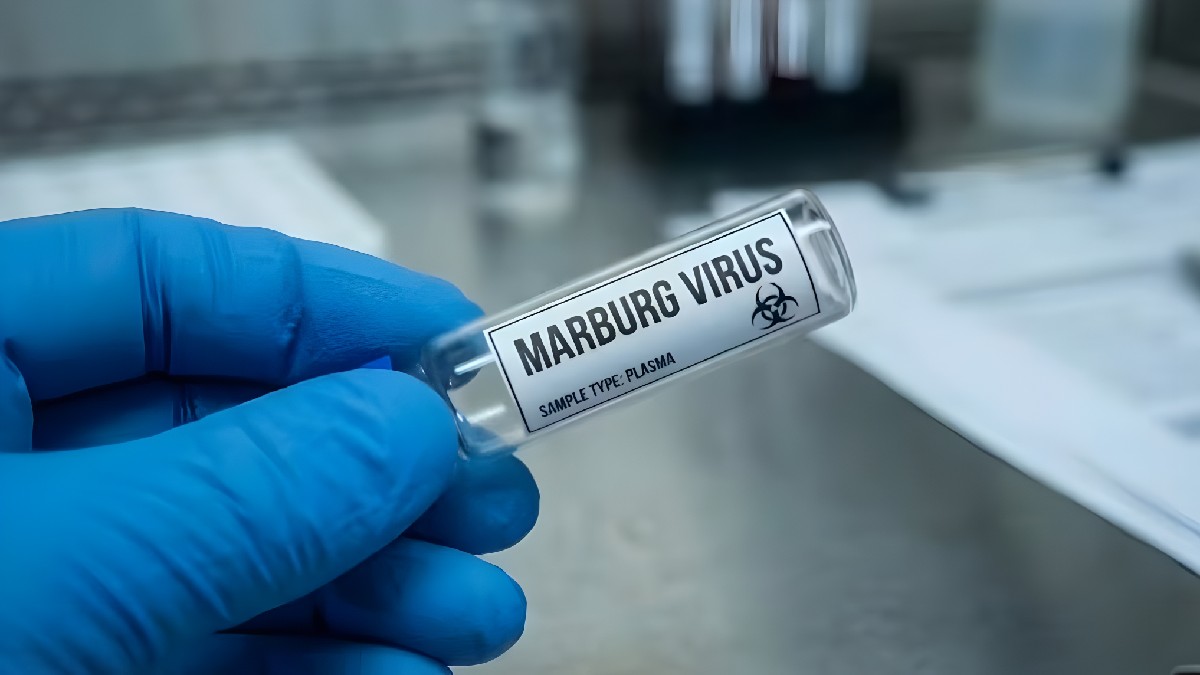 వేగంగా విస్తరిస్తోన్న మార్బర్గ్ వైరస్: ఇథియోపియాలో 8 మంది మృతి