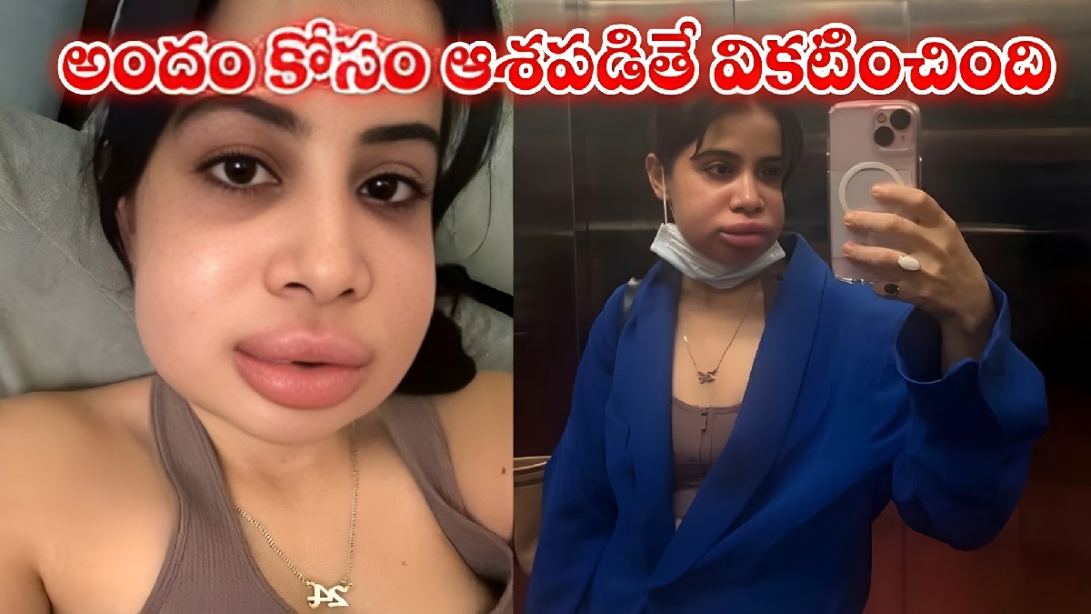 అందం కోసం ఆశపడితే వికటించింది: గుర్తుపట్టలేనంతగా మారిపోయిన హీరోయిన్.. షాకింగ్ లుక్!